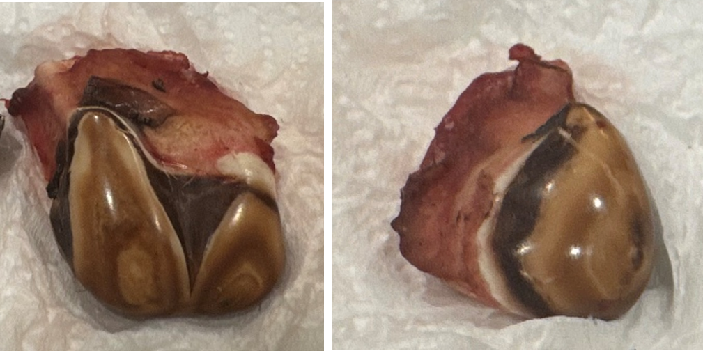 Deux photos de dents de wapiti arrachées de la mâchoire et exposées.