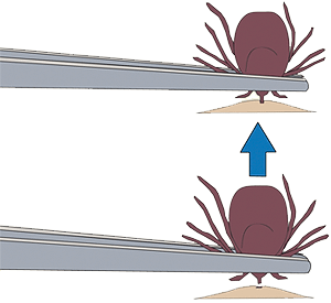 suppression des tiques